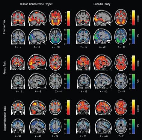 Scientists Have Used Fmri To Study Brain Activity For Years Now Some