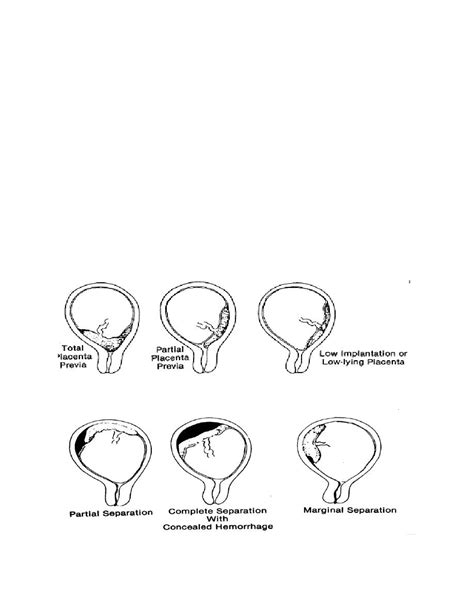 figure 6 5 various degrees of placenta previa obstetrics and newborn care i