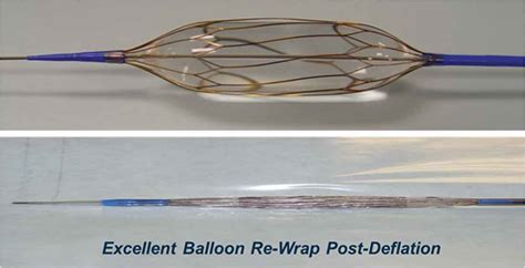 A Novel Valvuloplasty Scoring Balloon Catheter For Aortic Stenosis Structural Heart