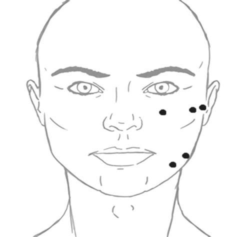 dry needling points of insertion source own download scientific diagram