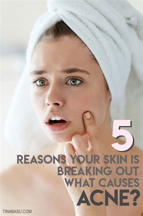 Causes Of Acne Understanding Your Breakouts