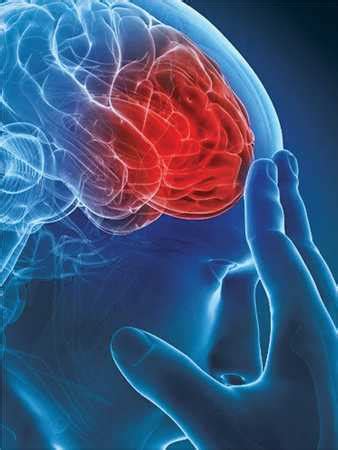 AVC Accidentul Vascular Cerebral Tipuri Cauze Simptome Tratament