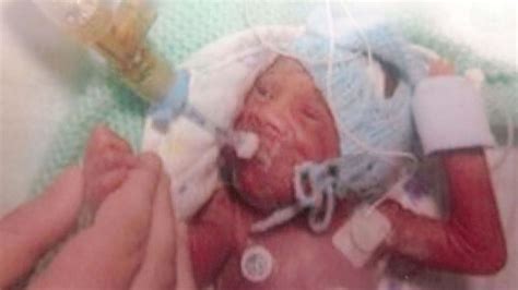 Meet The Miracle Baby Born Weighing 2lbs 4oz Who Defied Doctors