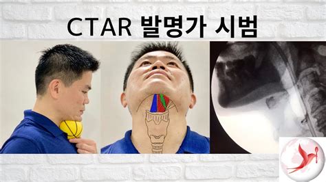 Korean Dysphagia Swallowing Exercise Chin Tuck Against Resistance