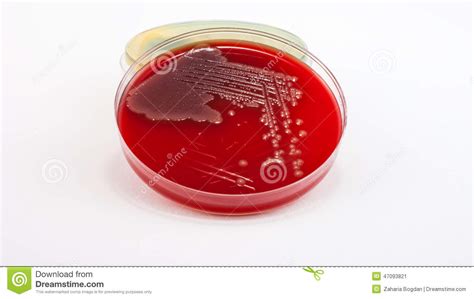 E Coli Bacteria Growing On The Plate Royalty Free Stock Image