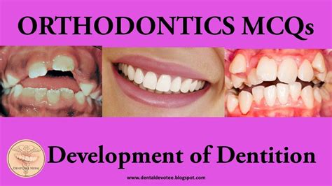 Mcqs In Orthodontics Development Of Dentition Youtube