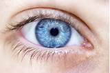 Images of Lasik Eye Surgery Change Eye Color