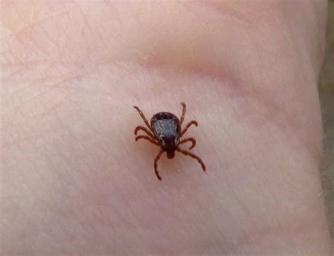 Canadian Wood Tick Catching Championship Looking To Break Record Of
