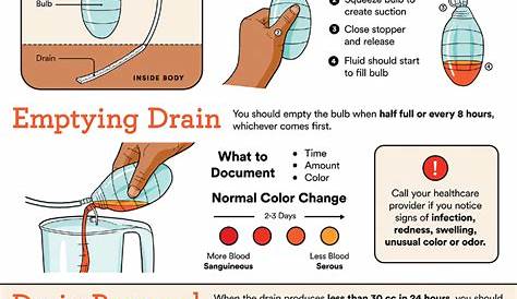 Infographic demonstrating active surgical drain care and removal