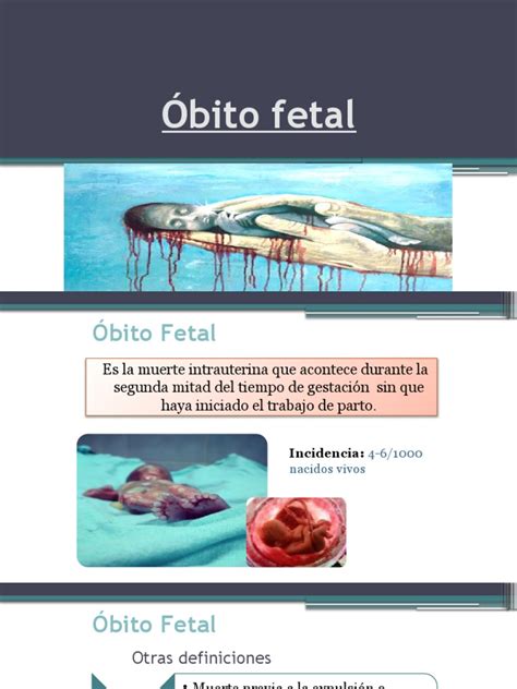 Copia De Óbito Fetal Pdf Feto El Embarazo