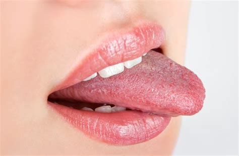 Dental Hygiene Reston Dental 5 Secrets Your Tongue Reveals About