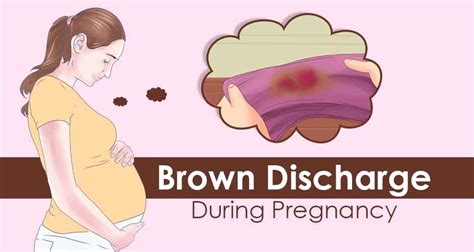 Brown Vaginal Discharge During Pregnancy Should You Worry