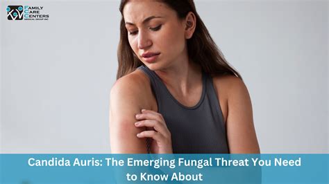 Candida Auris The Emerging Fungal Threat You Need To Know About