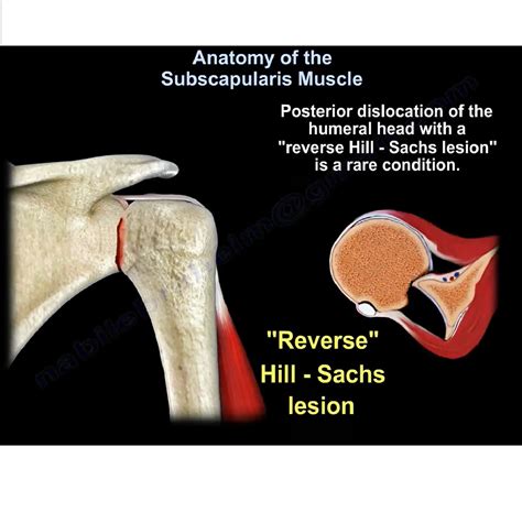 Anatomy Of The Subscapularis Muscle —