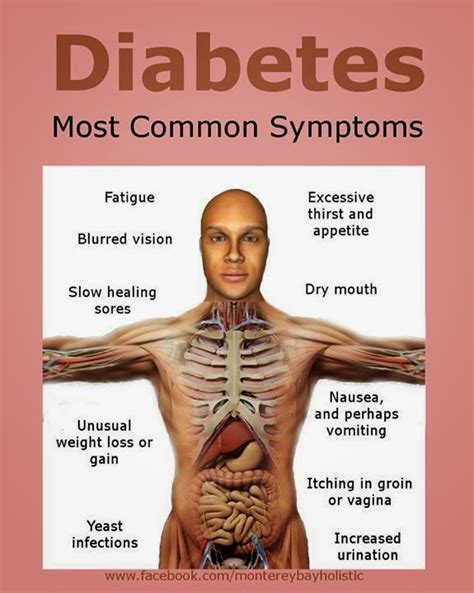 Type 2 Diabetes Symptoms Webmd Xanax