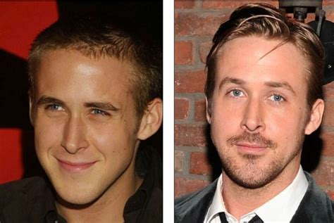 Has Ryan Gosling Received A Nose Job Then And Now Pictures Examined