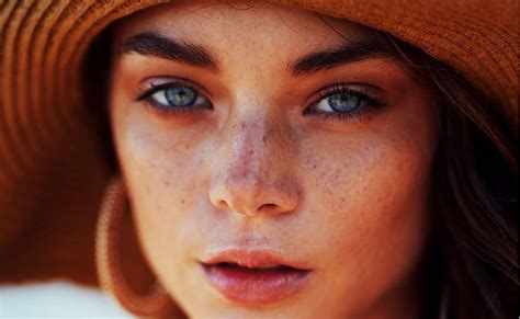 How To Get Rid Of Dark Spots On The Face Naturally Overnight Seema
