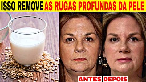 use apenas isso e elimine todas as rugas profundas do rosto rapidamente como acabar com as