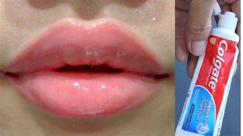 With Toothpaste, Get Baby Soft Pink Lips in just 7 Days Naturally at
