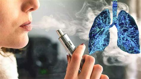 Substantial Evidence Of Link Between Vaping And Lung Disease As Patient Dies
