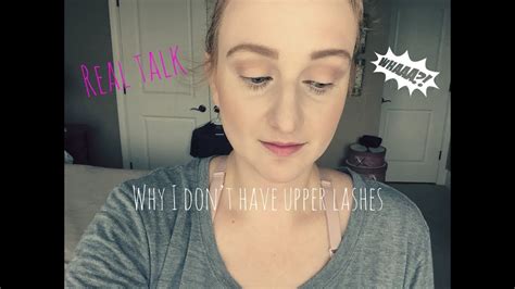 Why I Dont Have Eyelashes And Why Its Not A Big Deal My Trichotillomania Story Youtube