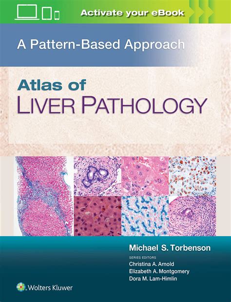Atlas Of Liver Pathology A Pattern Based Approach Mehul Traders