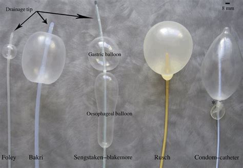 Intrauterine Balloon Hot Sex Picture