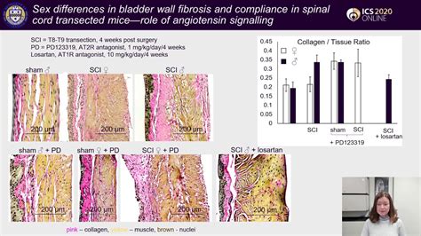 Ics 2020 Abstract 371 Sex Differences In Bladder Wall Fibrosis And