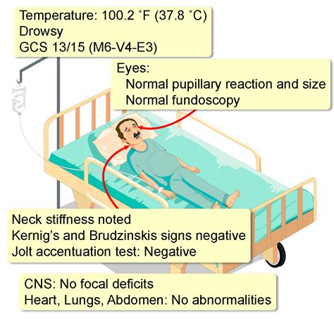 Acute Encephalitis Interactive Case Study Clinical Odyssey By