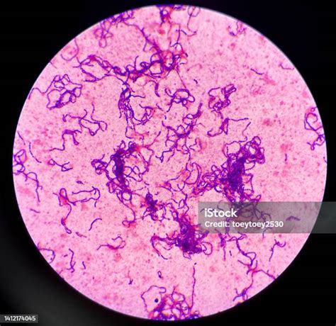 Gram Positive Cocci In Chain Stock Photo Download Image Now Medical