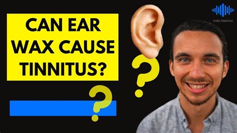 Can Earwax Cause Tinnitus Youtube