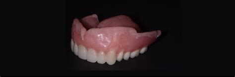 A Primer On Soft Denture Liners Spear Education