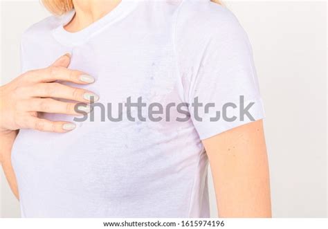 Closeup Asian Woman Hyperhidrosis Sweating Young Stock Photo 1615974196