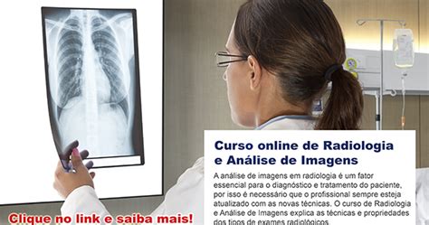 Dicas De Radiologia Tudo Sobre Radiologia Curso Online De Radiologia Hot Sex Picture