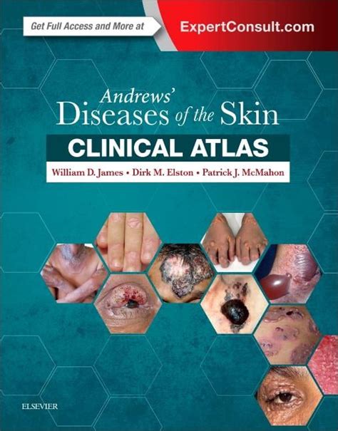 Andrews Diseases Of The Skin Clinical Atlas Hardcover