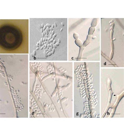 Cladosporium Cladosporioides A B Colony On Pda After Seven And 14