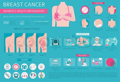 Breast Cancer Medical Infographic Diagnostics Symptoms Treatment Women`s Health Set Stock