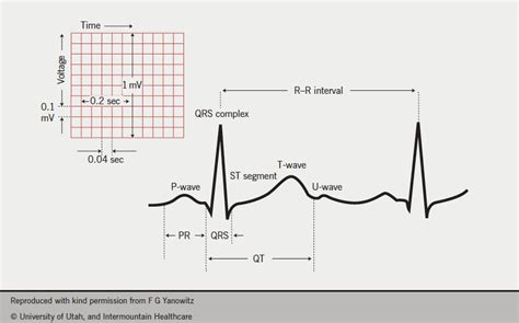 My Top 10 Tips For Ecg Interpretation The British Journal Of Cardiology