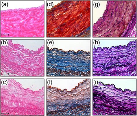 Histology Ac Hande Staining Of Native Carotid A And
