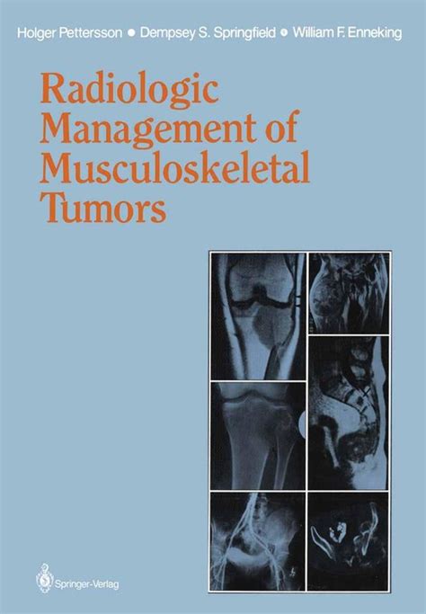 Radiologic Management Of Musculoskeletal Tumors Ebook William F