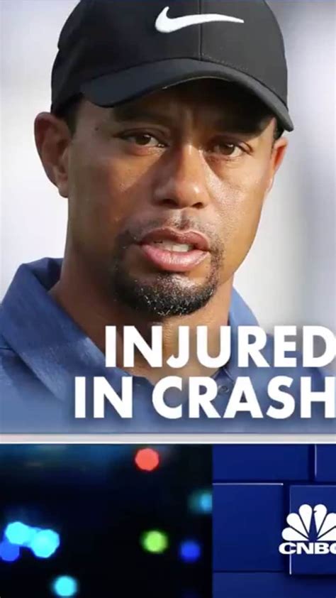 Cnbcさんのインスタグラム動画 Cnbcinstagram「tiger Woods Has Been Hospitalized With Serious Leg Injuries