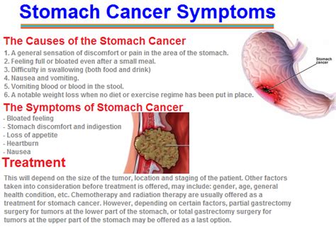 Stomach Cancer Symptoms Menstrualcrampss