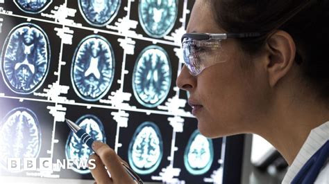 Alzheimers Drug Lecanemab Hailed As Momentous Breakthrough Bbc News