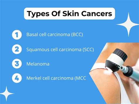 What Does The Beginning Of Skin Cancer Look Like Associated