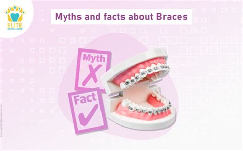 Myths And Facts About Braces Elite Dental Care