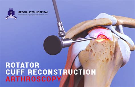 Rotator Cuff Arthroscopy Best Orthopedic Hospital In Ernakulam
