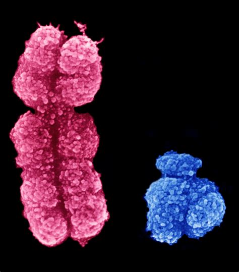Communiquer Les Aneuploïdies Des Chromosomes Sexuels Détectées Par Nipt College Genetics