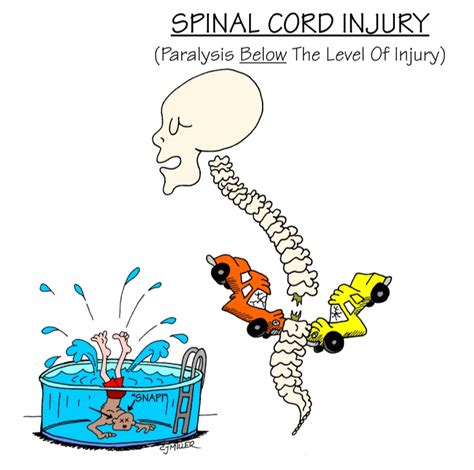 Spinal Cord Injuries Can Have A Number Of Physical Effects Including
