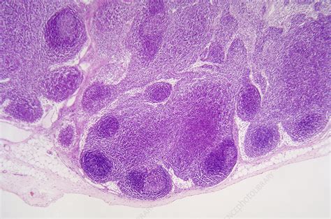 Lymph Gland Section Lm X35 Stock Image C0126871 Science Photo
