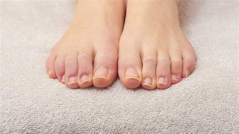 What Causes Thick Toenails Nail Ftempo